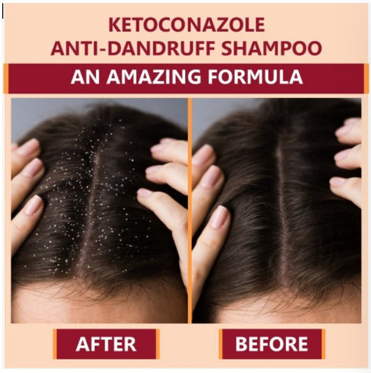 New Ketokem - Bottle of 110ml Anti-Dandruff Shampoo Pack of - 1